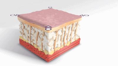 有法令纹特显老教你几招抚平细纹,法令纹这么显老得如何搞定