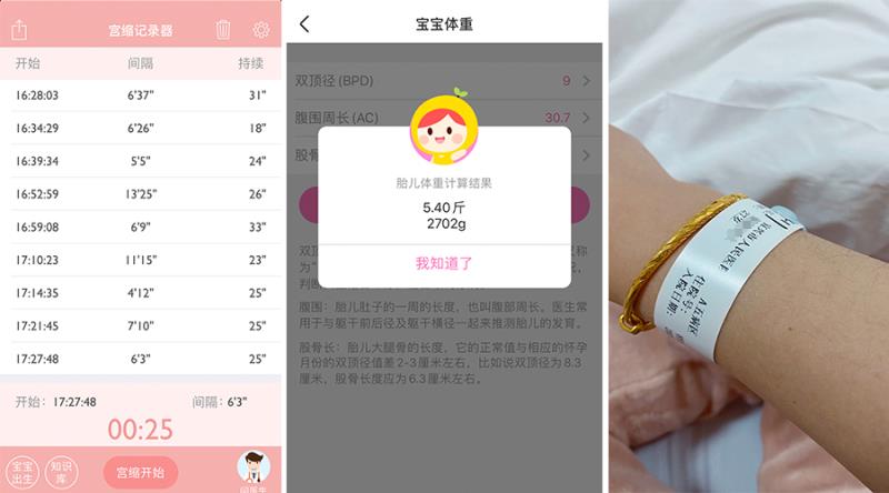 怀孕之路历经坎坷,熊猫血妈妈产检日常