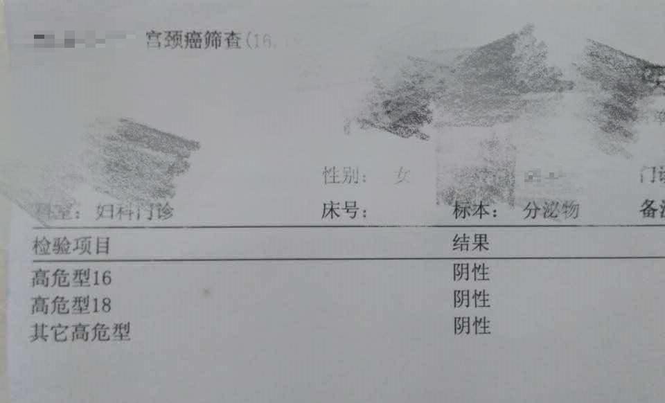 九价疫苗需要检查hpv还是tct,打九价前检测hpv和tct是必须的吗