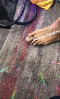 勇士迎好消息？格林曝光杜兰特畸形脚趾！这是在释放某种信号