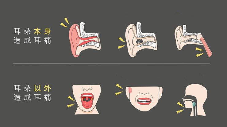 小朋友耳朵疼痛会复发吗,小朋友耳朵痛