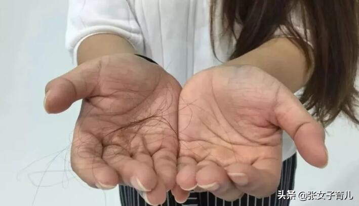 宝妈哺乳期掉头发,哺乳期宝妈严重掉头发是什么原因