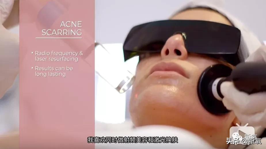 刘诗诗最近生图,刘诗诗旧照脸又胖又大