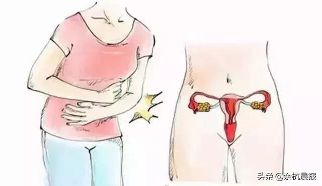 注意！近50%的余杭女性都被这个毛病折磨！这次带来一个好消息！