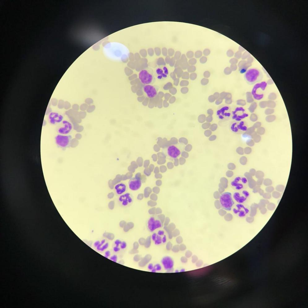 猫咪爪垫红肿怎么办,猫咪的爪垫会蜕皮吗