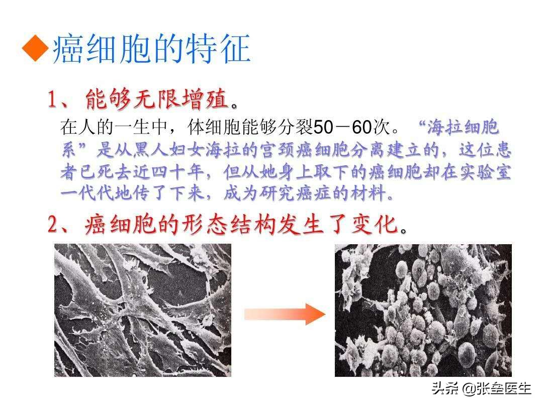 癌症患者怎么不让癌细胞快速扩散,癌细胞扩散会引起恶性肿瘤吗