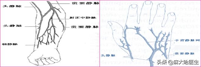 静脉扎针不回血是怎么回事,静脉针不好扎怎么办