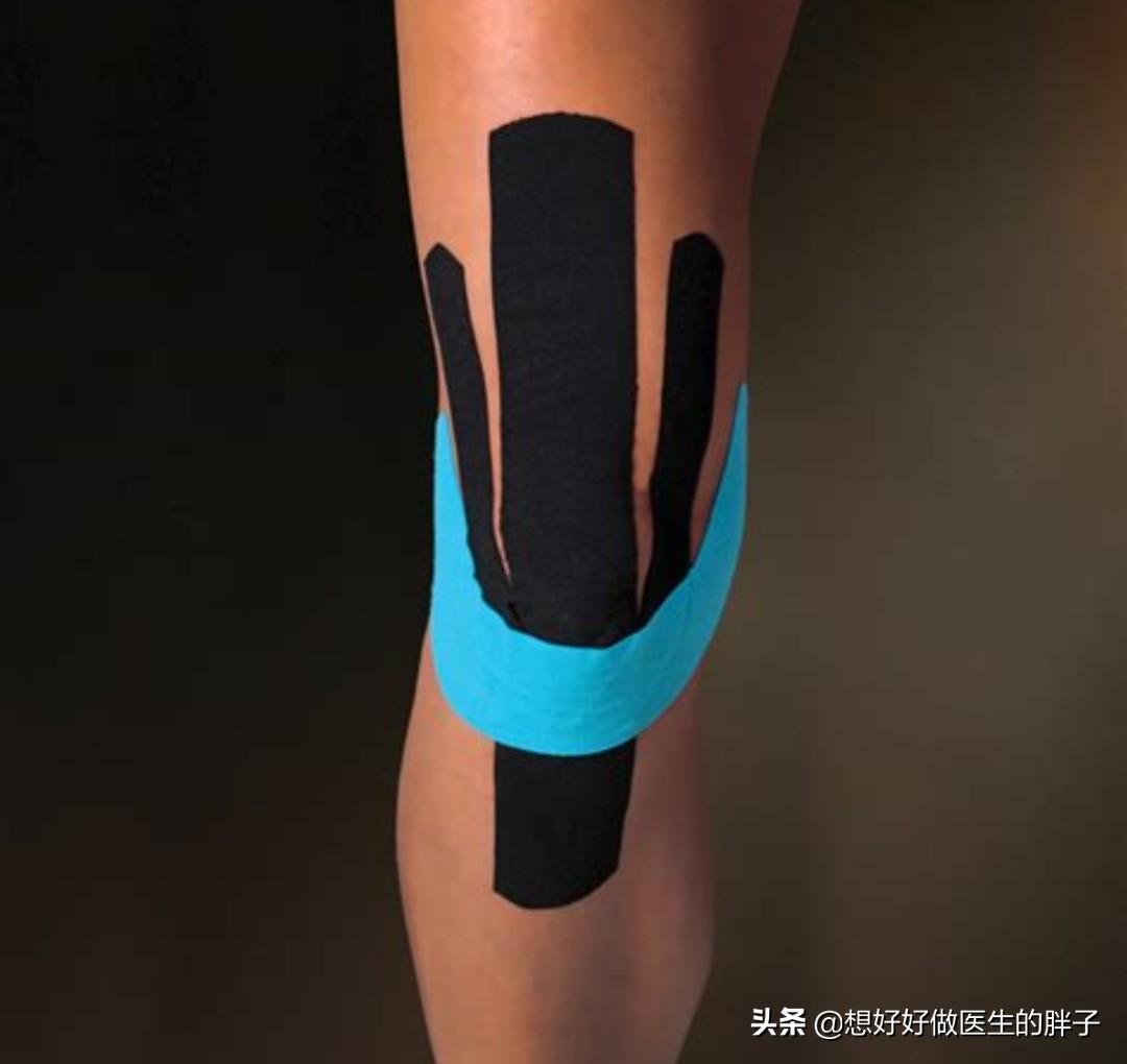 特殊时期尽量不出门,运动选择室内原地慢跑,可以吗?医生告诉您