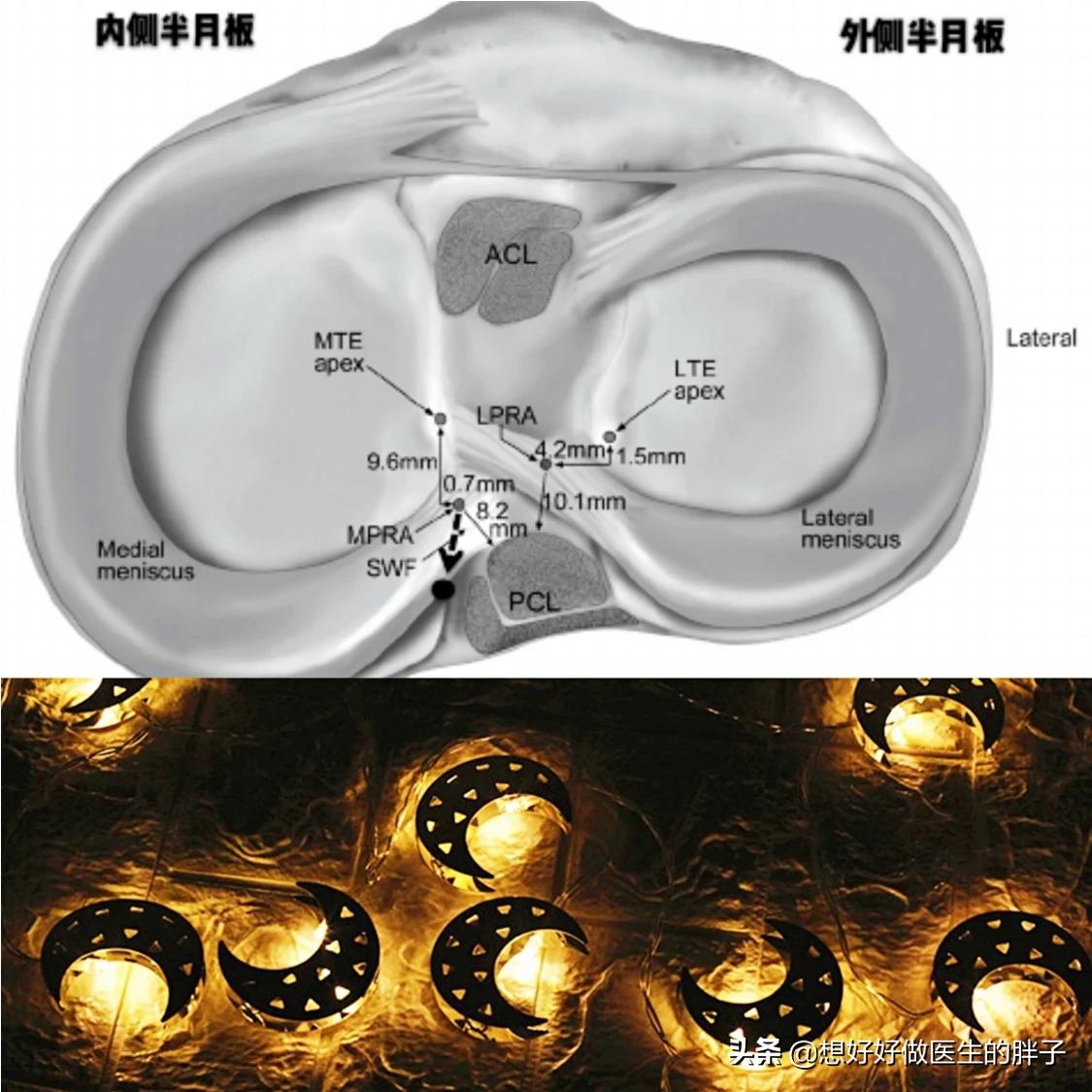 为什么足球运动员不会半月板受伤,半月板伤病对足球运动员影响大吗