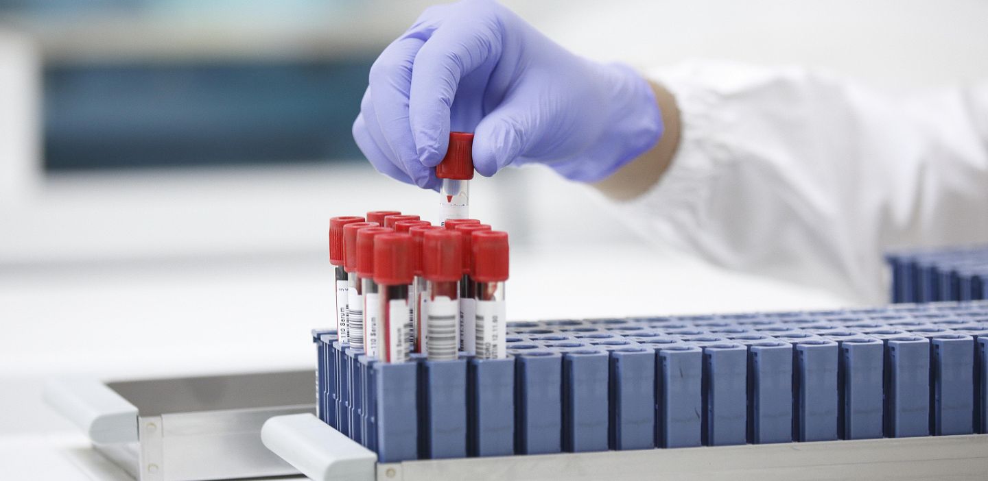 罗氏诊断主要是做什么的,罗氏诊断简介