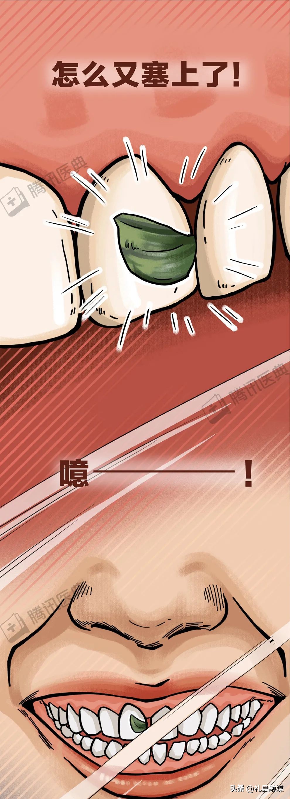 牙齿吃肉总是塞牙怎么治疗,吃肉吃菜老是塞牙怎么办