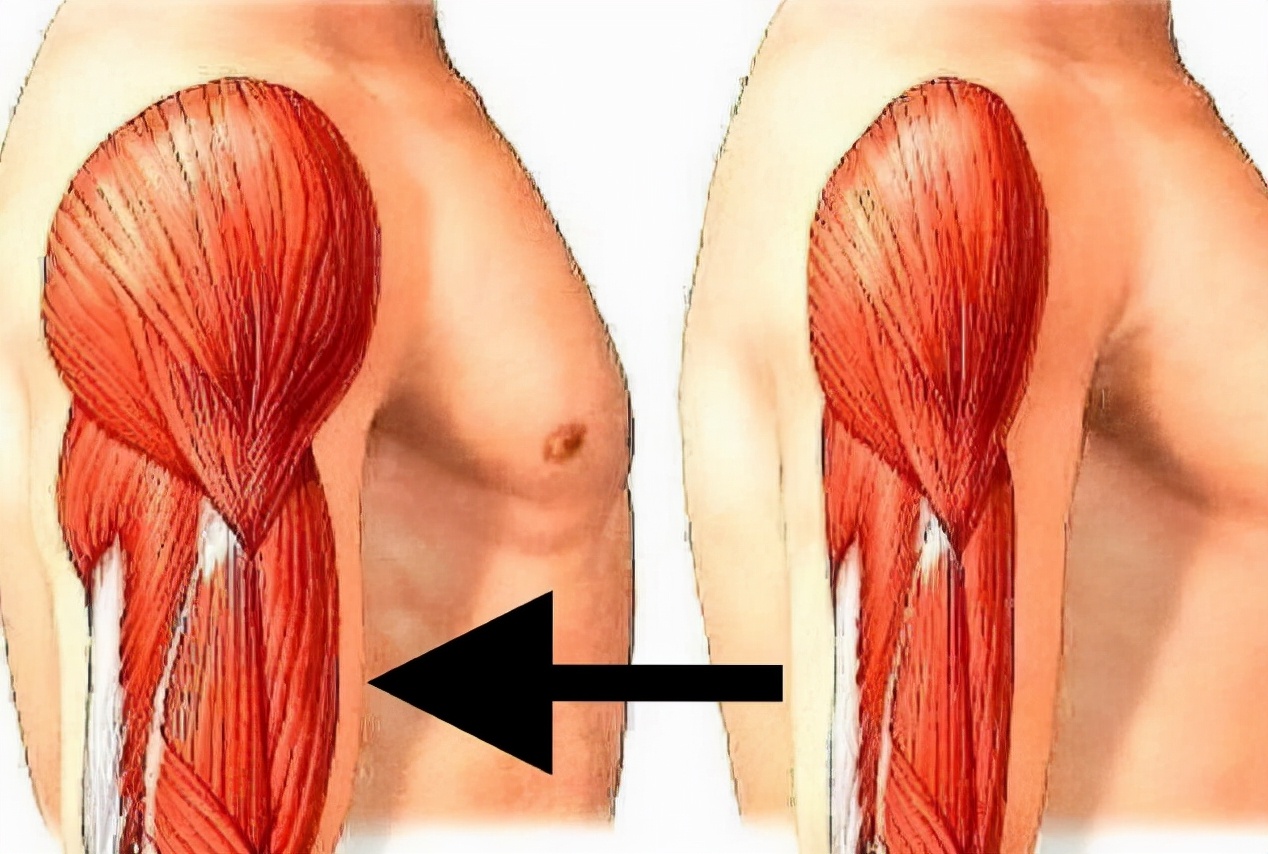 产后盆底肌电疗有必要吗,产后盆底功能康复指什么地方