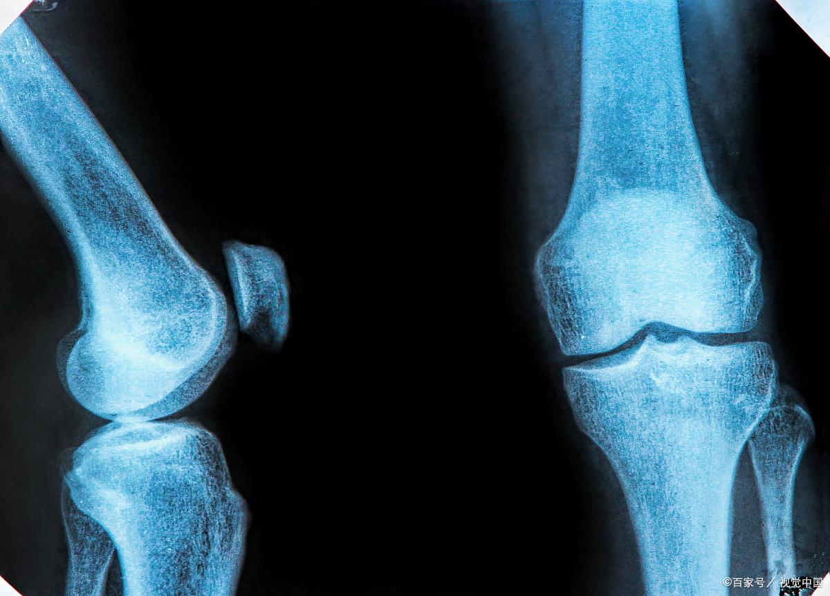 18岁净身高170男生还可以长高吗,15岁女孩身高168还能长高吗