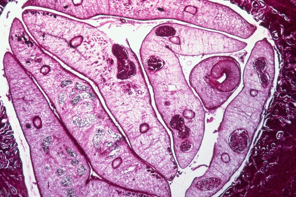 男子腹痛检查发现肠子破了,男子腹部疼痛医生检查出意外