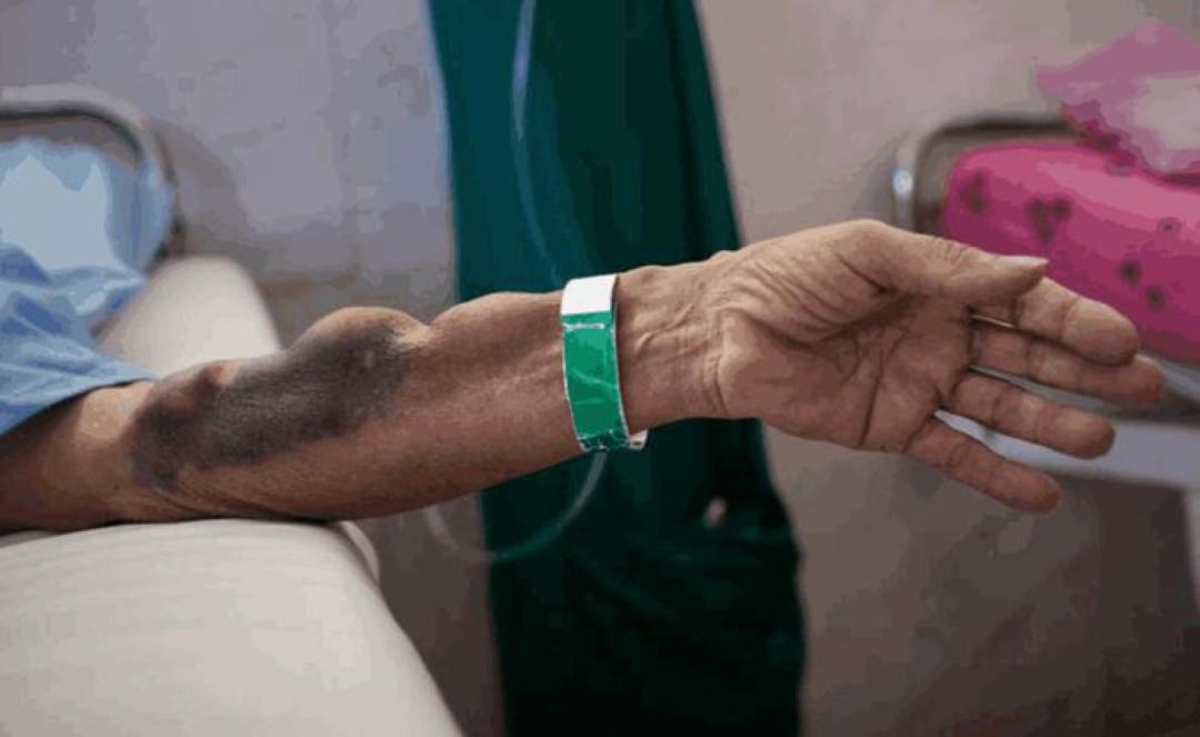 为了不饿死，伊朗人正在卖掉*丸睾**