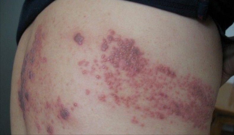 世上最痛苦的三种酷刑,世上最痛的5种病