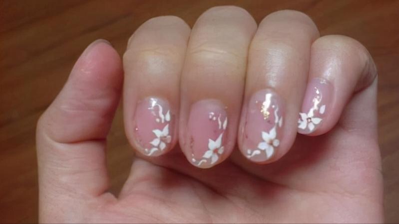 指甲往肉里长怎么办,指甲老往肉里钻