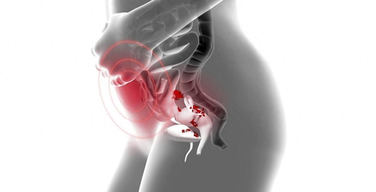 没有阴道的女人，和正常女性有哪些不同？还能有夫妻生活吗？