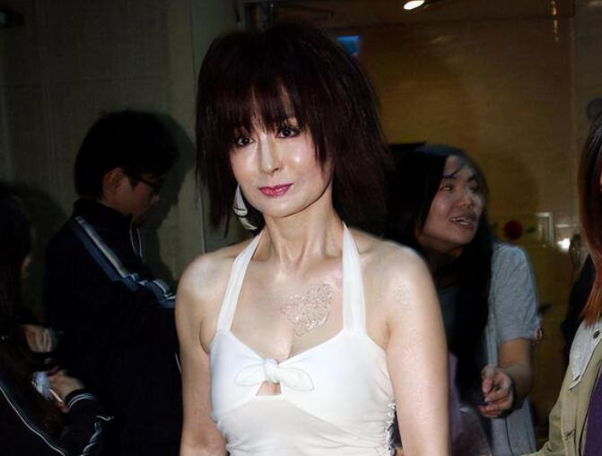 面部衰老皱纹解剖图,面部皱纹衰老对比图