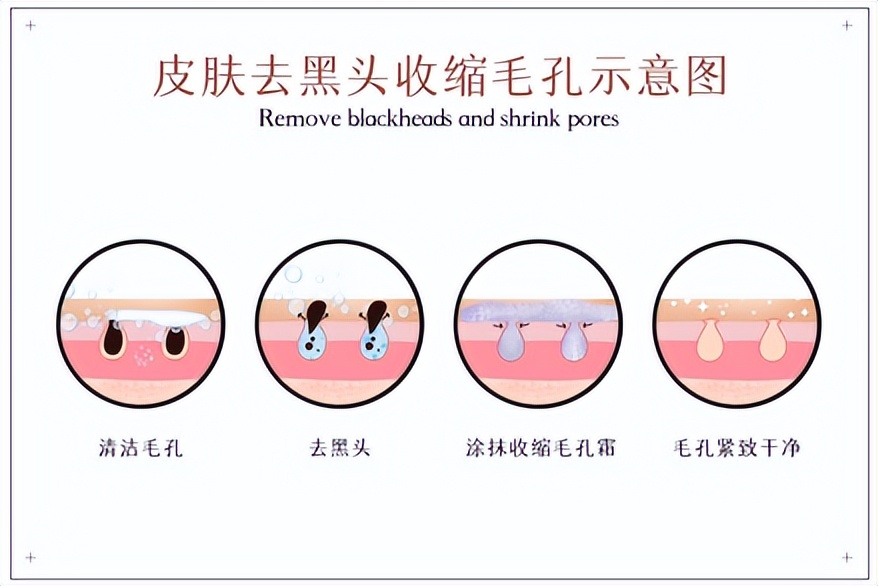 改善黑头这两点不可不知,去黑头的方法你真会么