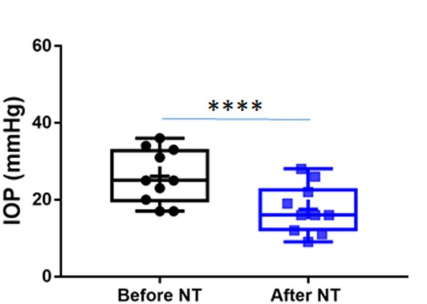rho激酶抑制剂多少钱,rho激酶抑制剂是什么