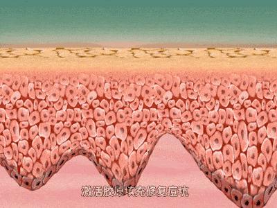 痘痘反反复复怎么办,脸上的痘痘反反复复