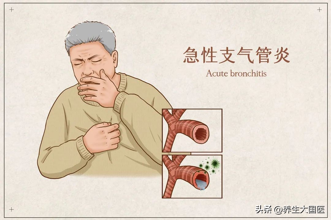 中医治疗咳嗽黄痰妙招,一到秋天就咳嗽有痰中医