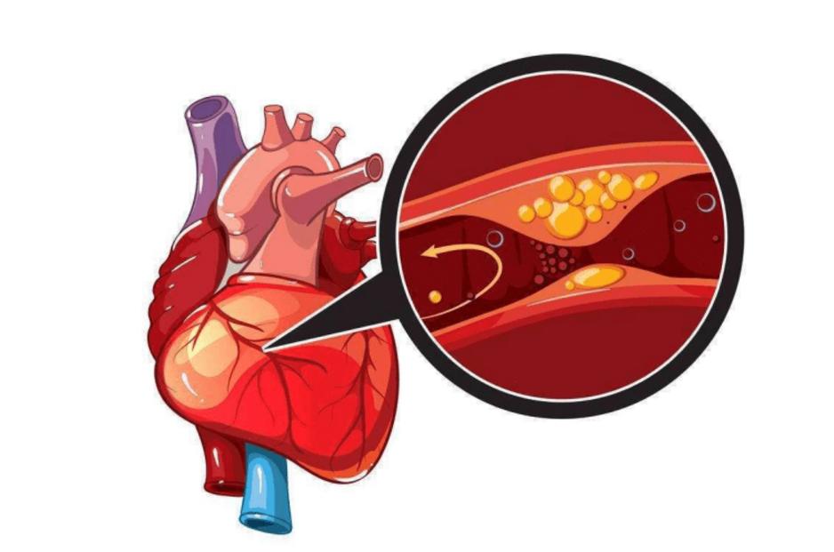 脑出血没发作之前有什么症状吗,脑出血前8个征兆有什么治疗方法