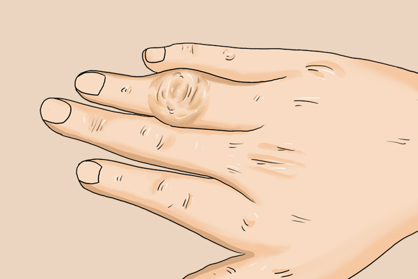 硒对生命健康的影响,硒元素是每个人都需要补的吗