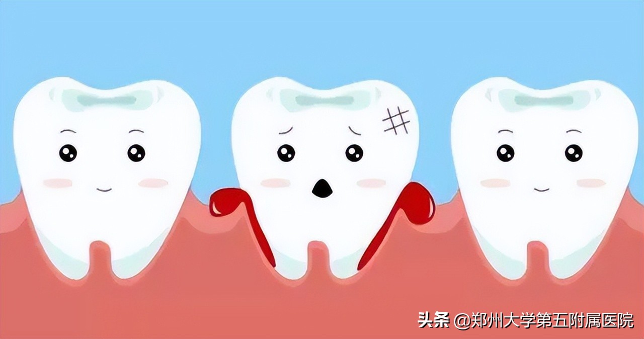 请问医生牙龈出血是怎么了,医学科普牙龈总是出血该怎么办呢