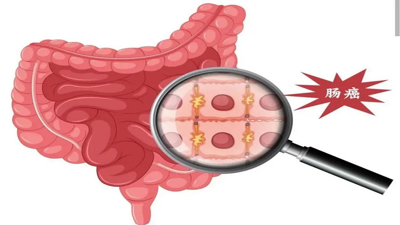 上了年纪也要注意身体,上了年龄身体需要体检
