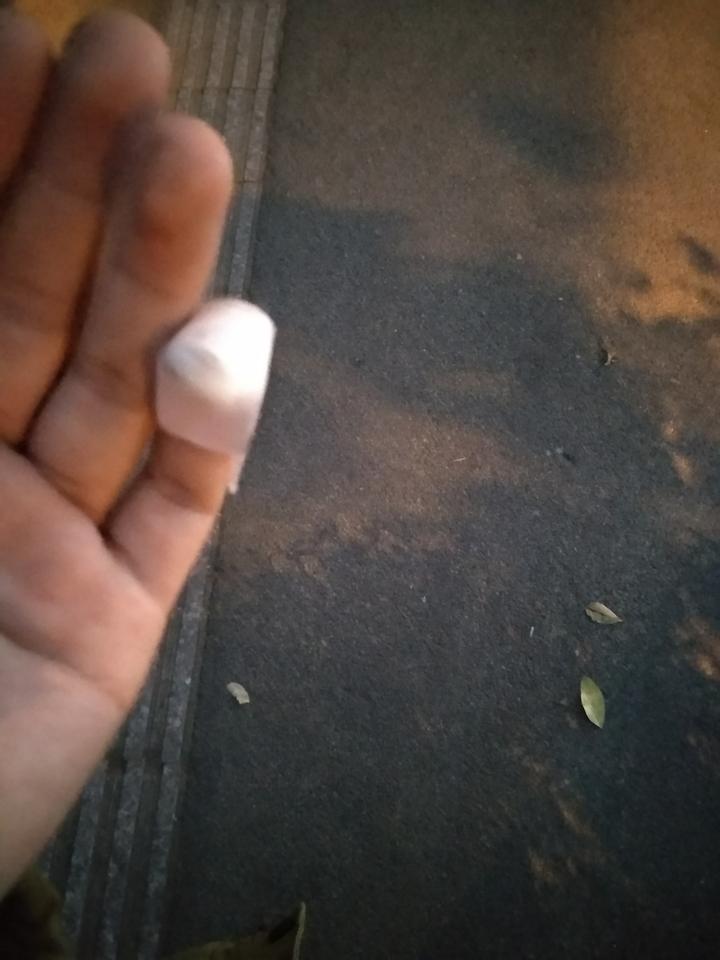 男子杀害前妻后本想*焚自**，结果烧到裆部受不了，跳进水中成功自救