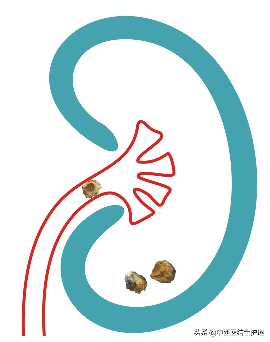 糖友正确喝豆浆,糖友喝豆浆在空腹前还是空腹后好