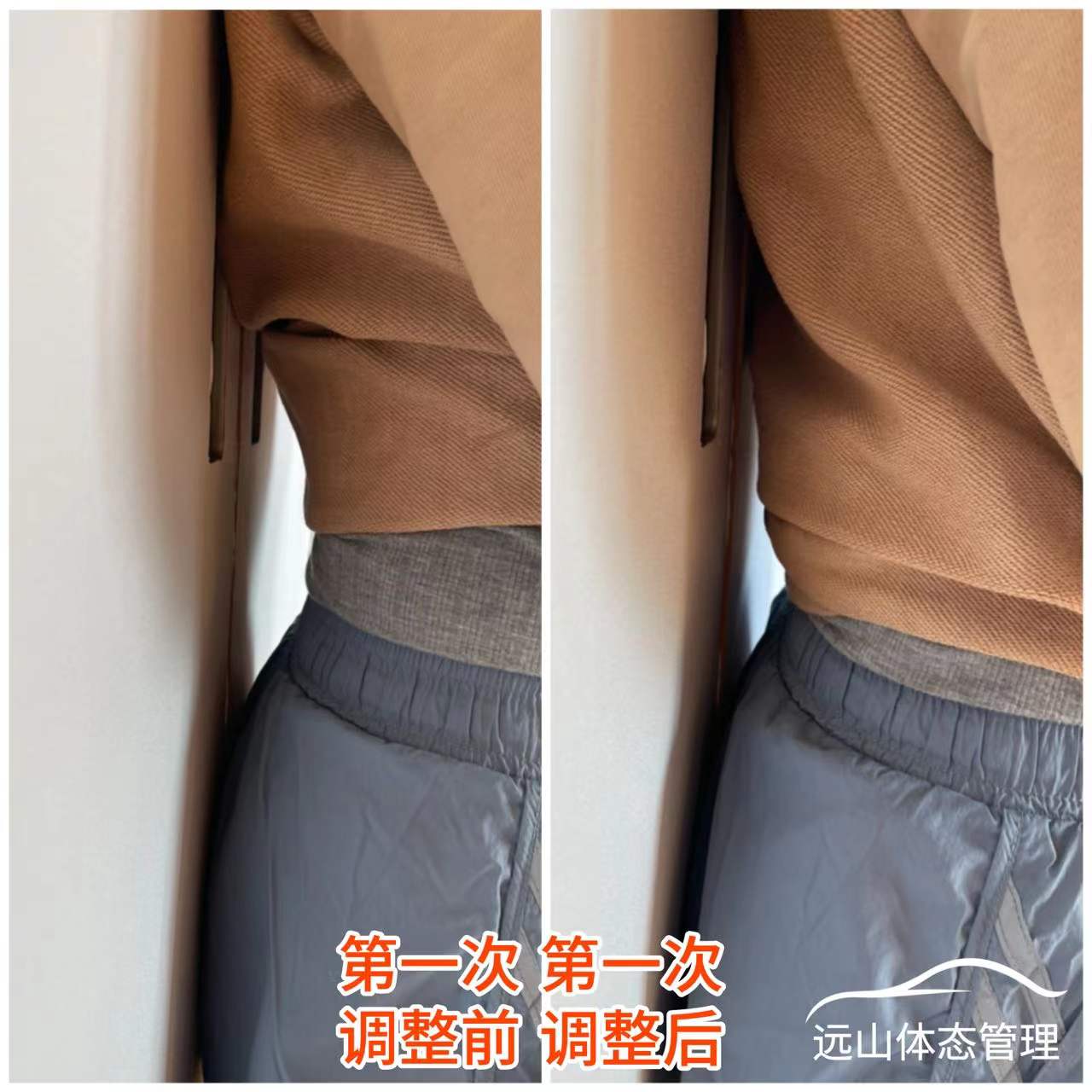 o型腿案例,宝妈o型腿