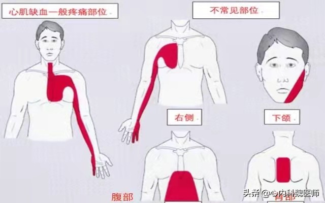 心肌缺血吃什么药效果更好,心肌缺血一般吃什么药可以缓解