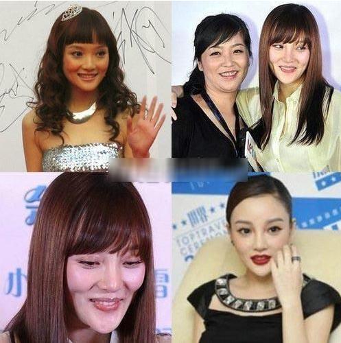 有一种倔强叫做没整容,有种倔强叫不承认整容