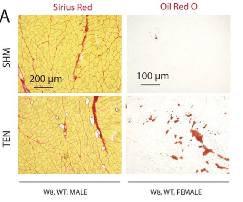核因子,NFκB,在临床治疗上,是否与腱切断术的肌肉萎缩无关?