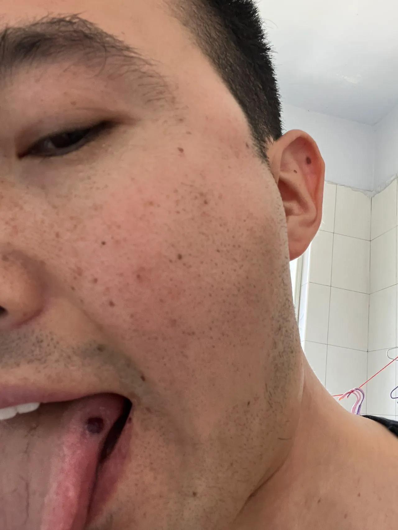 急性白血病的确诊依据,白血病m3的确诊方法