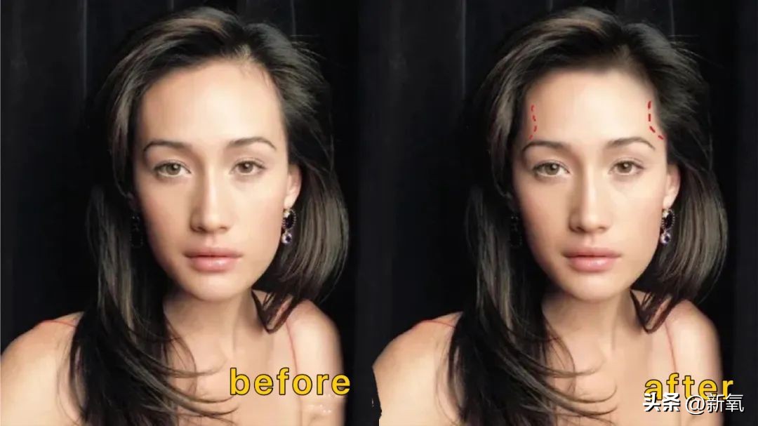 发际线高低怎么样才合适,发际线高低有没有影响运气