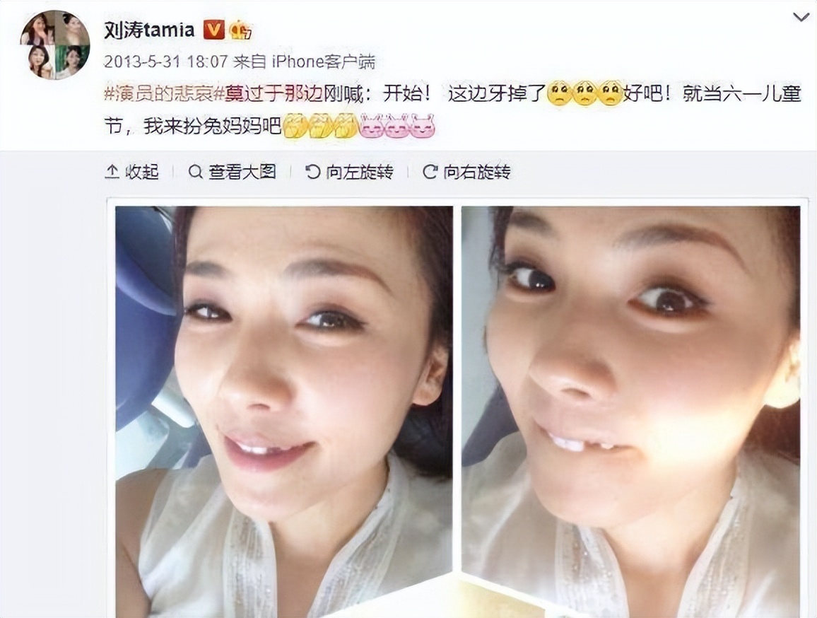 娱乐圈女星龅牙露一颗牙,娱乐圈的假牙女星