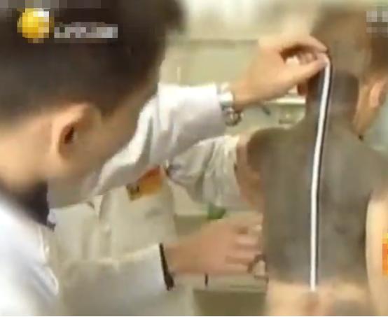 河北女子割皮救父,河北行唐母亲割皮救儿子