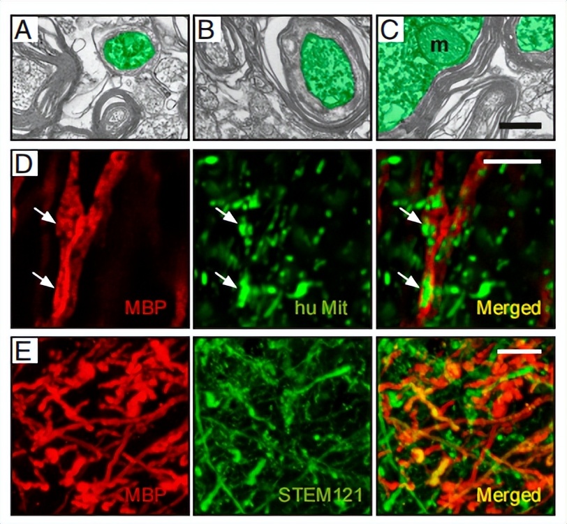 诱导多能干细胞发展历程,诱导多能干细胞的功能及优点