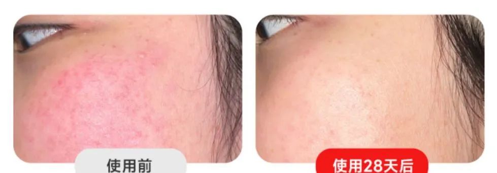 大排灯美容仪哪个品牌好,现在流行的大排灯美容仪可靠吗