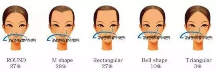 发际线对颜值的重要性,发际线对颜值的影响