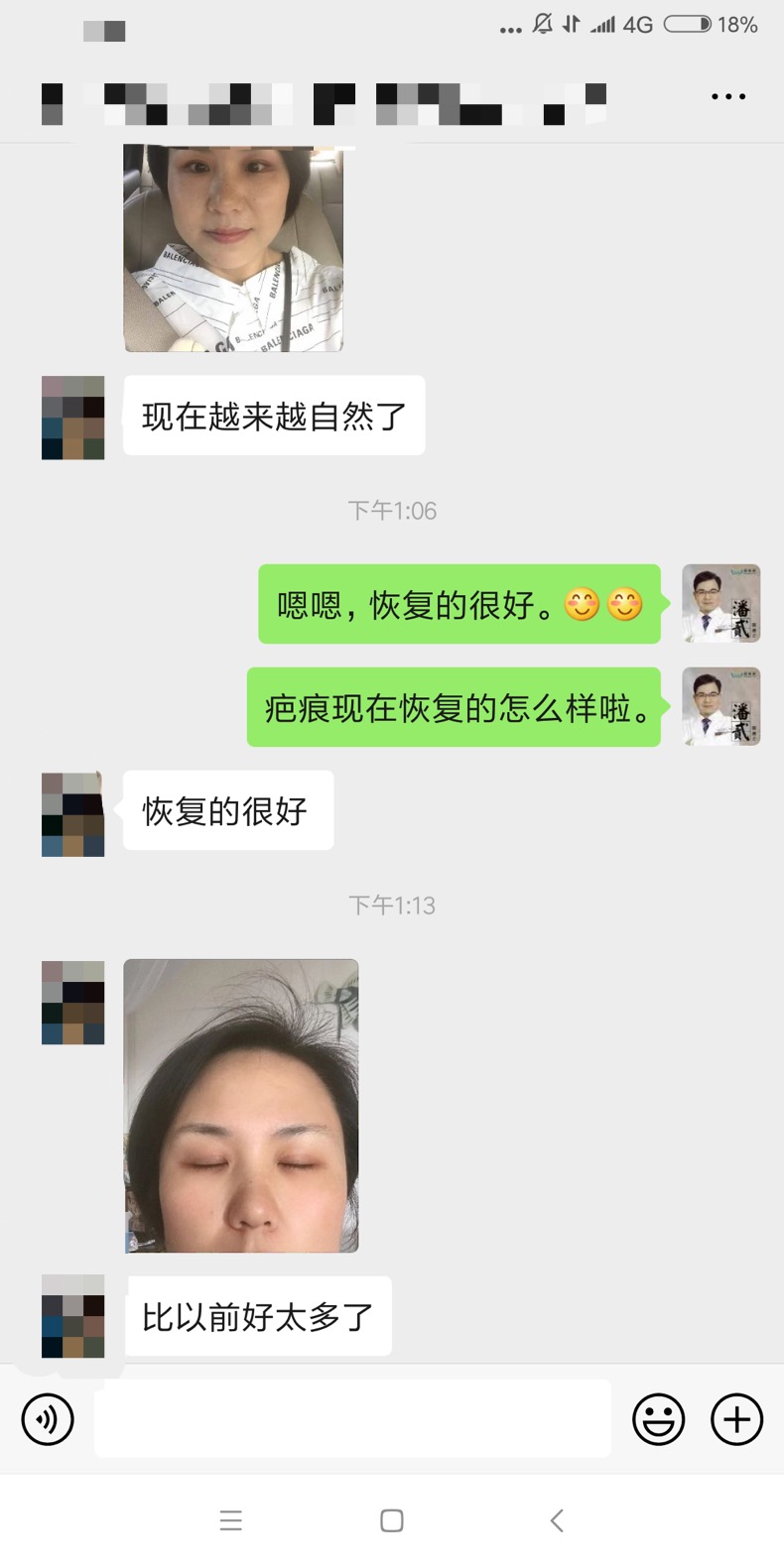 东莞整形做双眼皮,东莞整形医院割双眼皮