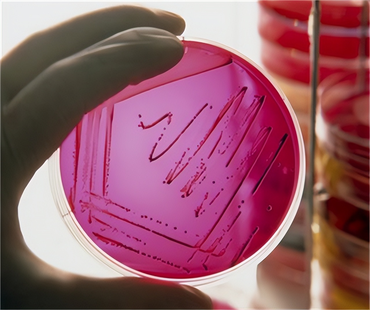 总感觉大便拉不干净，这是怎么回事？医生提醒：留意这3种病