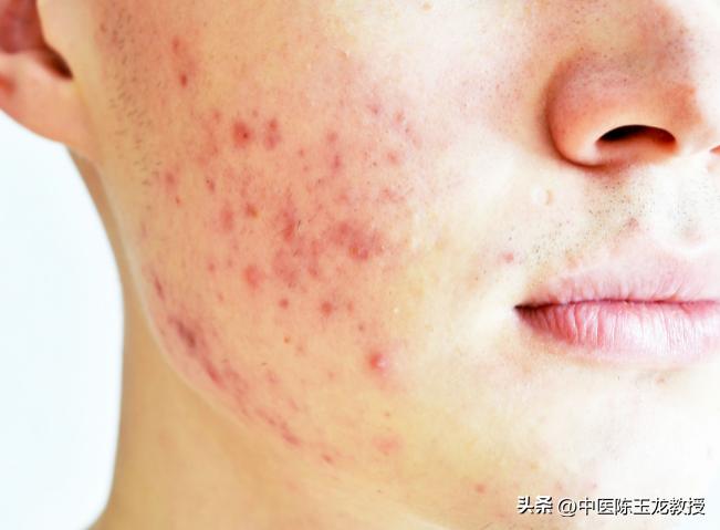 参苓白术散吃多长时间能有效,参苓白术散可以长期吃一年吗