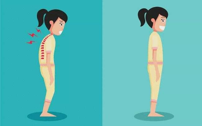 脊柱侧弯保守治疗可以报销吗,脊柱侧弯手术15万能报销多少