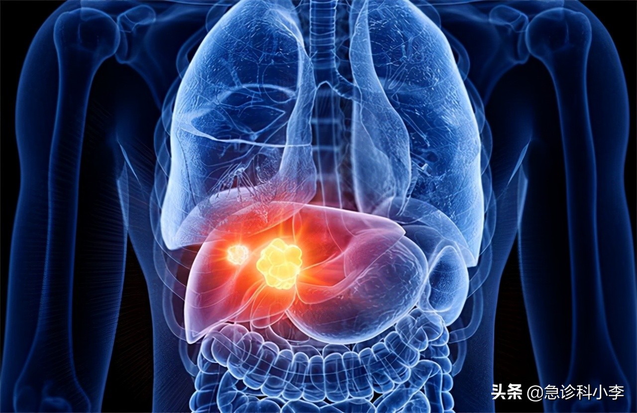 睡觉时突然腿抽筋是缺钙引起的吗,睡觉腿抽筋除了缺钙还有3个原因