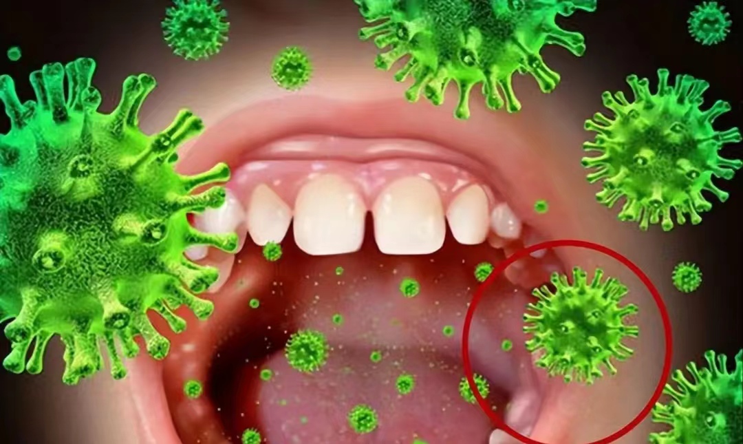 怎样治疗牙结石用简单的方法,牙结石的治疗全过程